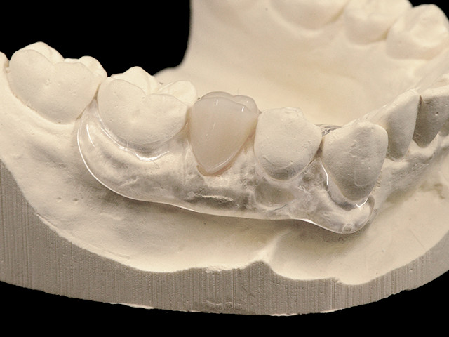 flexprovisorium-03