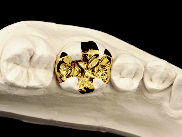 gold-01