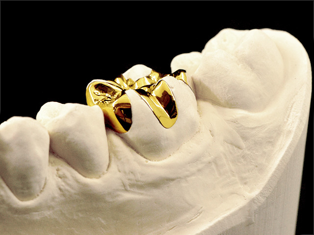 gold-02