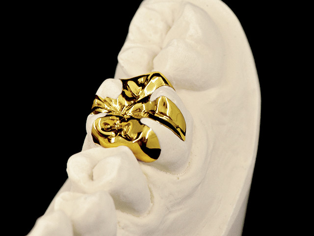 gold-03