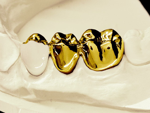 vollguss-gold-01