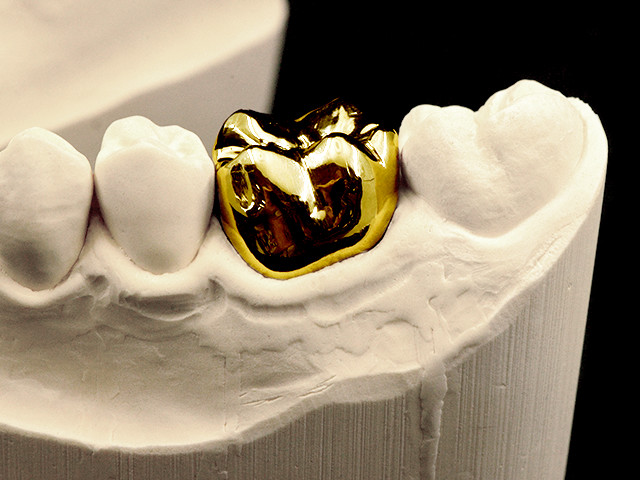 vollguss-gold-01