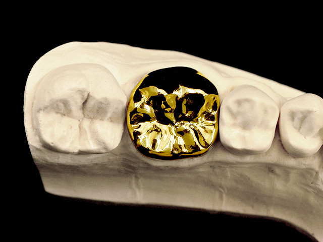 vollguss-gold-02
