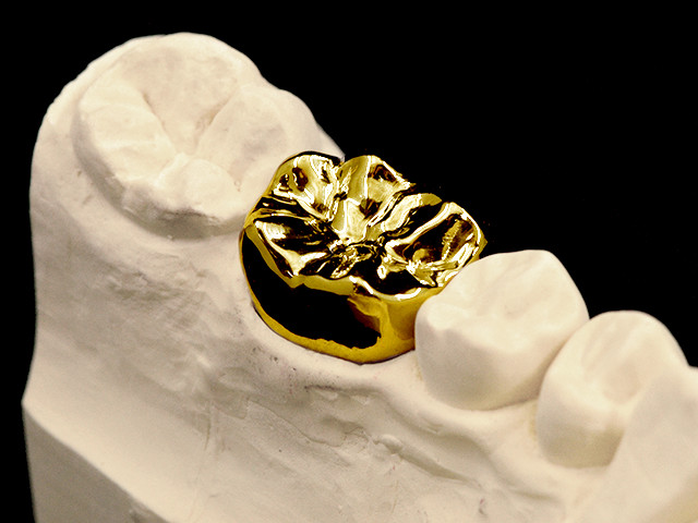 vollguss-gold-03